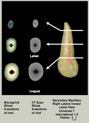 Mx Lateral Roots.png